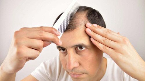What are the reasons of hair fall in male